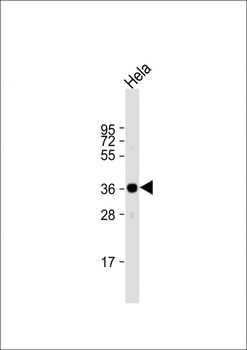 ARPC1A Antibody (C-term)