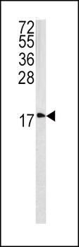 CAV3 Antibody (N-term)