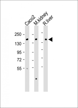 ATP7B Antibody (C-term)