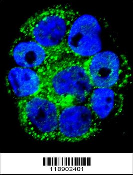 IL1RN Antibody (C-term)