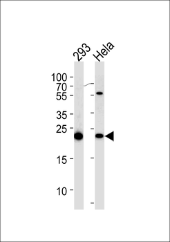 IL1RN Antibody (C-term)