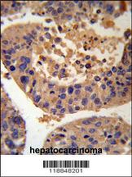 AGXT Antibody (Center)