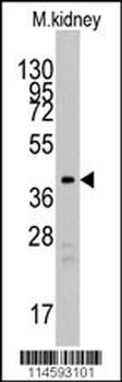 TBRG1 Antibody (N-term)