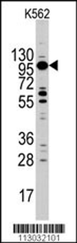 Myosin 1C (MYO1C) Antibody (C-term)