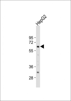 Glypican 3 (GPC3) Antibody (N-term)
