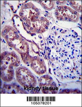 APP Antibody (C-term D672)