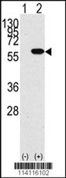 YB1 (YBX1) Antibody (N-term)