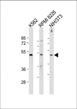 MEF2C Antibody (S387)