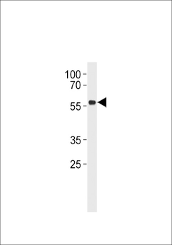 p53 Antibody (S315)