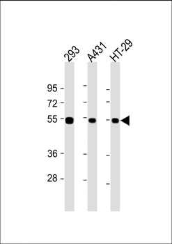 p53 Antibody (S315)