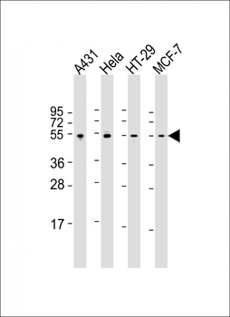p53 Antibody (S315)