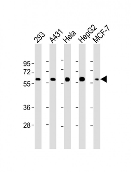 p53 Antibody (S315)