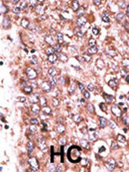 WISP3 Antibody (Center)