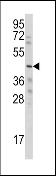 WISP3 Antibody (Center)