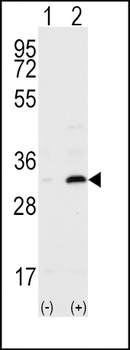 CD82 (ST6) Antibody (C-term)