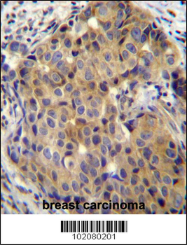 ST14 Antibody (C-term)
