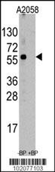 HSC70 Interacting Protein HIP (ST13) Antibody