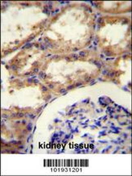 SEPT9 Antibody (C-term)