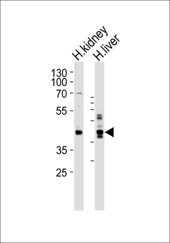 SEPT9 Antibody (C-term)