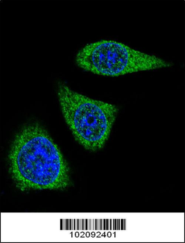MMP7 Antibody (Center)