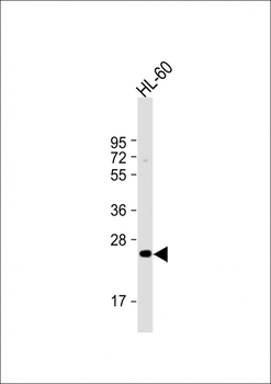 MMP7 Antibody (Center)