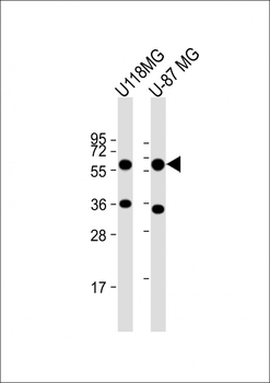 MMP3 Antibody (Center)