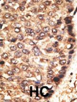 MMP24 Antibody (Center)