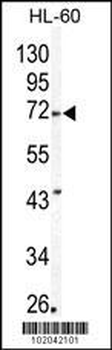 MMP24 Antibody (Center)