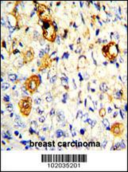 MMP19 Antibody (C-term)