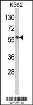 MMP19 Antibody (C-term)