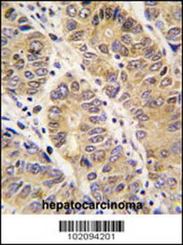 MMP13 Antibody (C-term)