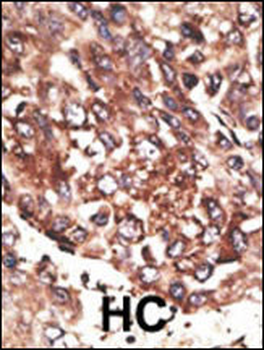 MMP13 Antibody (C-term)