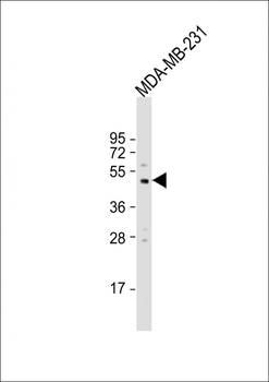 MMP13 Antibody (C-term)