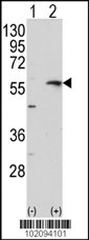 MMP13 Antibody (C-term)