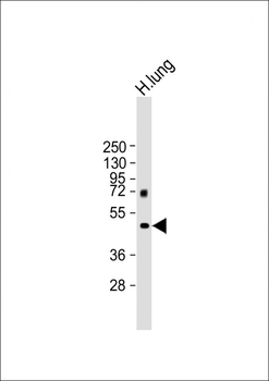 MMP12 Antibody (C-term)