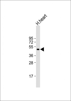 MMP12 Antibody (C-term)