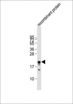MLL2 Antibody (C-term)