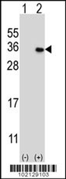 MAGEH1 Antibody (C-term)