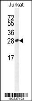 ICOS Antibody (C-term)