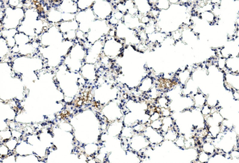 GREMLIN Antibody (C-term)