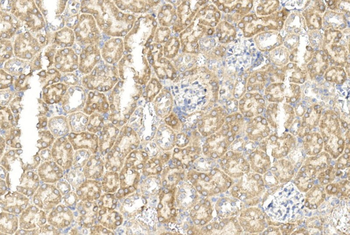 GREMLIN Antibody (C-term)
