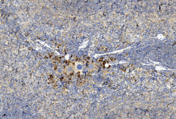 GREMLIN Antibody (C-term)