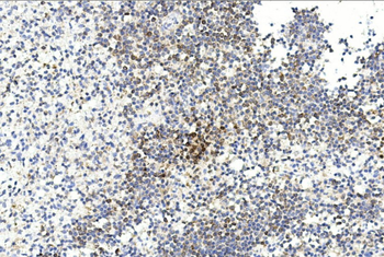 GREMLIN Antibody (C-term)