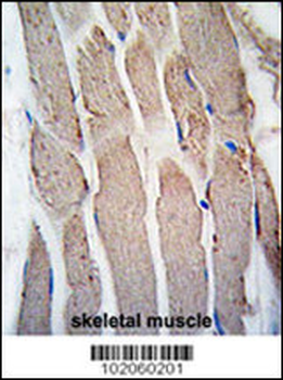 GREMLIN Antibody (C-term)