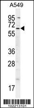 cIAP2 (BIRC3) Antibody (N-term)