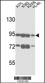 ABCB5 Antibody (N-term)