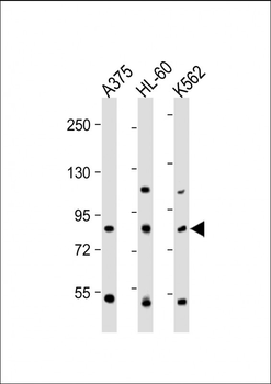 ABCB5 Antibody (N-term)