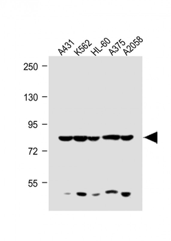 ABCB5 Antibody (N-term)