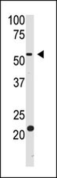 BACE2 Antibody (Center)