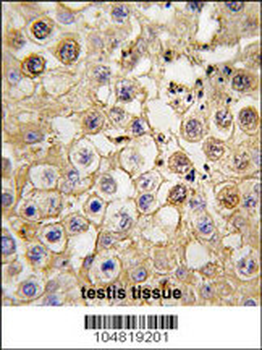 ACE2 (SARS Receptor) Antibody (C-term)